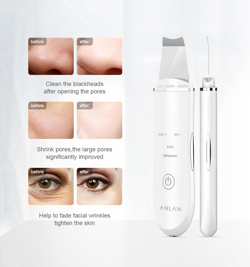 Ultrasonic Skin Scrubber Multi Pack